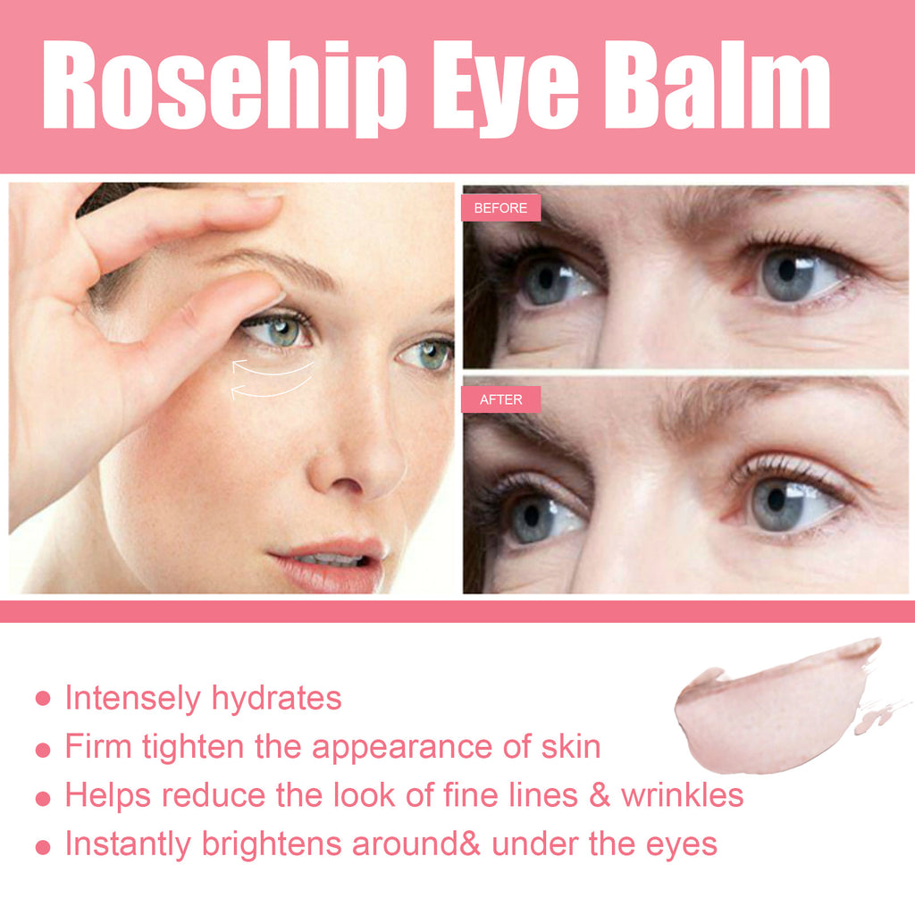 Rosehip Renewing Eye Balm