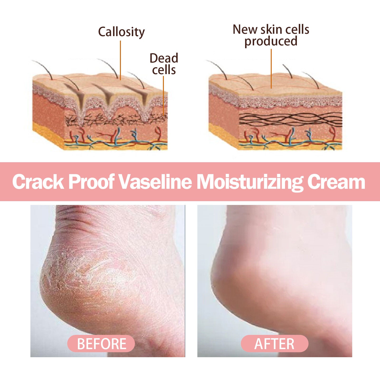 Healing Hand & Foot Repair Cream