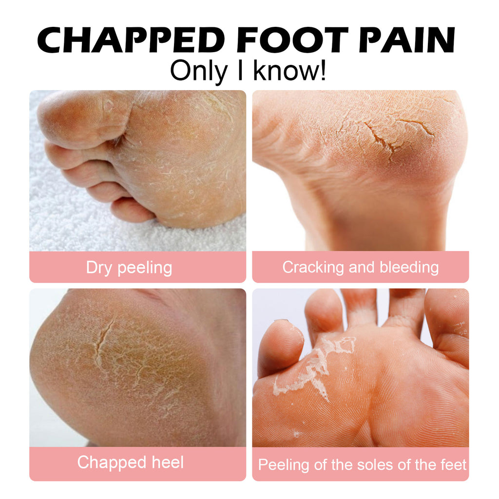 Healing Hand & Foot Repair Cream
